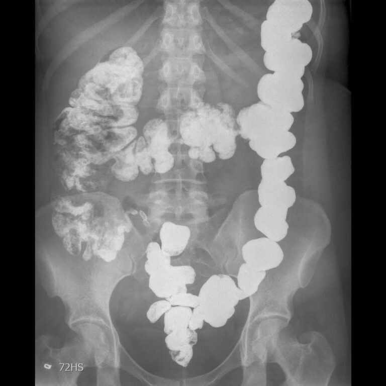 MMI.6A7HK MATSUSHITA MOTOR Tape Ricambio Panasonic Originale. EUR 23,00 - Foto 9